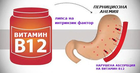 Лечение в12 дефицитной анемии схема