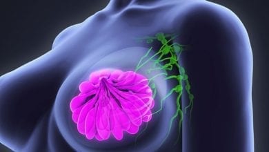 рак-на-гърдата-причини-лечение-1440x810