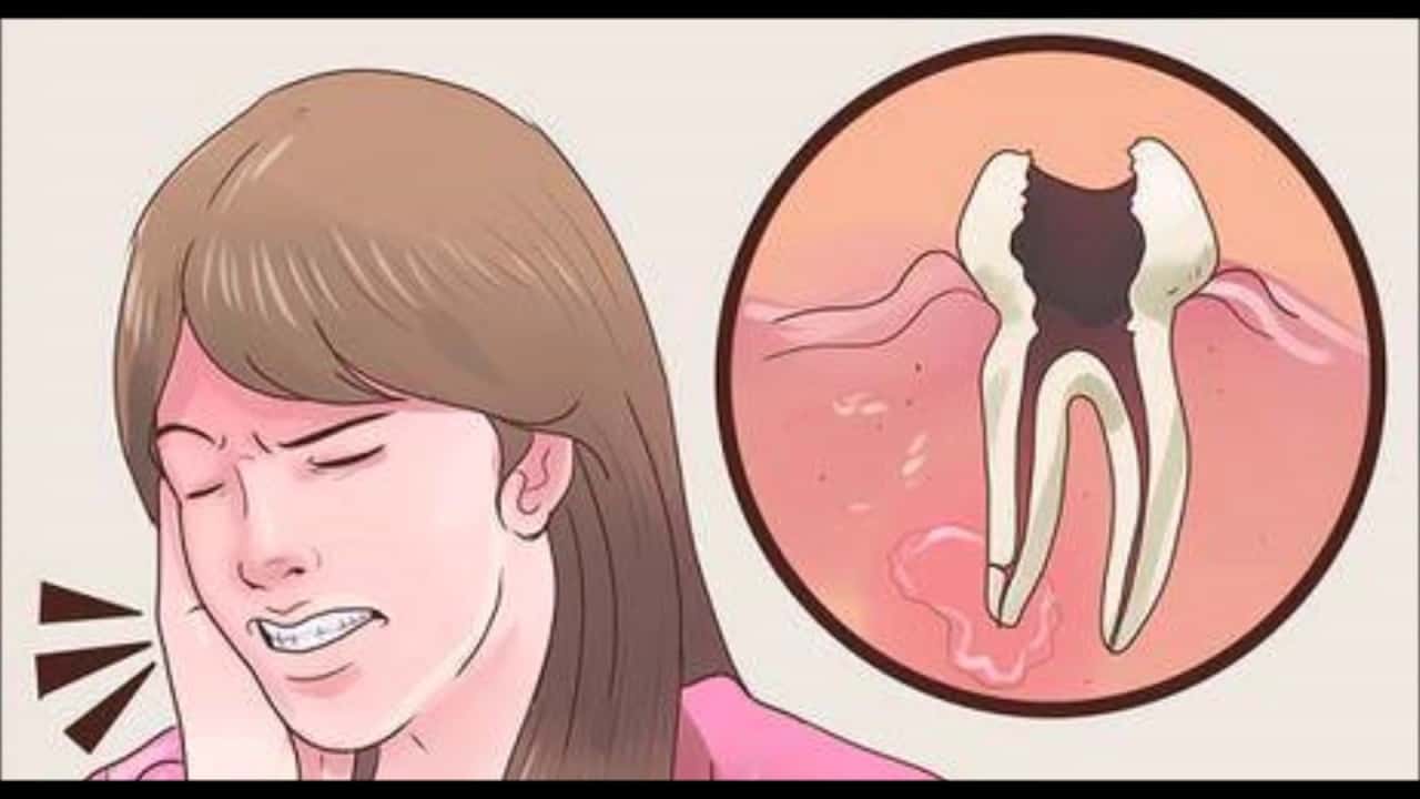 какво-причинява-зъбобол