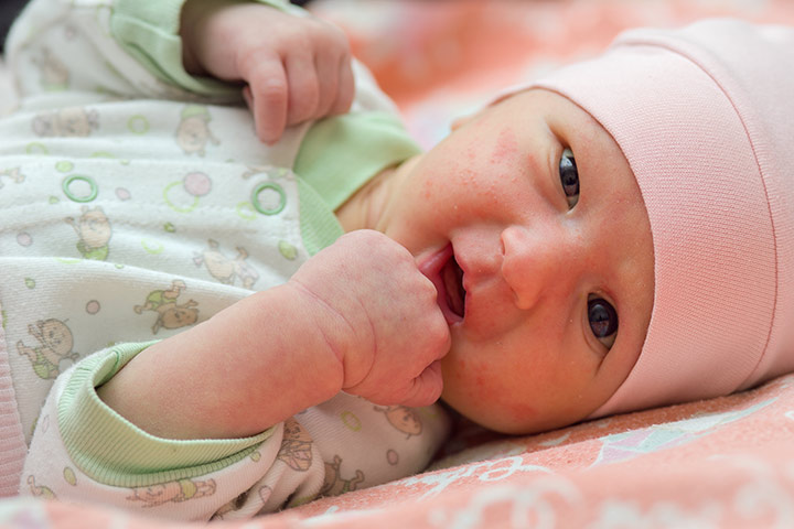Причини за зачервено гърло при бебета