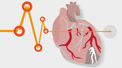 Вродени Сърдечни Дефекти: 7 Вида