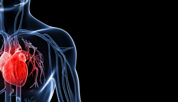 Какво е Сърдечен удар (миокарден инфаркт)