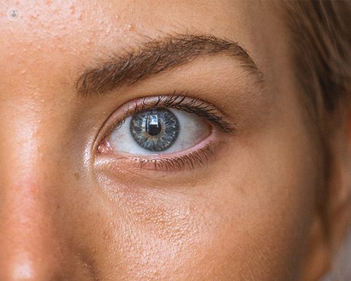 Глаукома: Какво представлява и как се Лекува