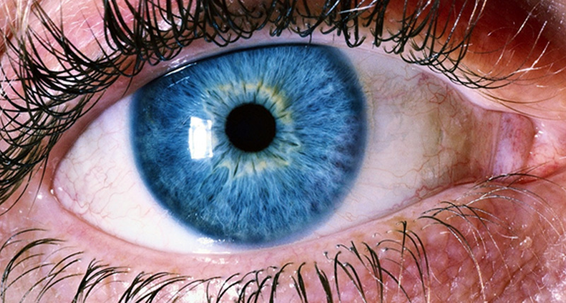 Отлепване на ретината: Какви са причините и лечението