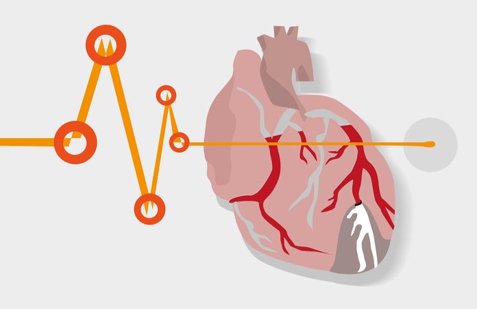 Вродени Сърдечни Дефекти: 7 Вида