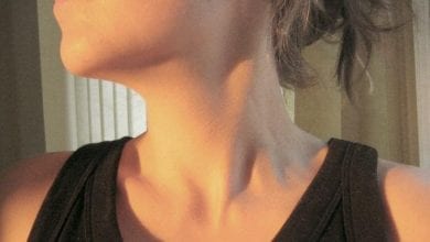 Хиперфункция на щитовидната жлеза: Хранене и Начин за лечение