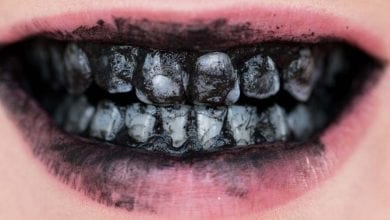 Как се избелват зъбите с активен въглен