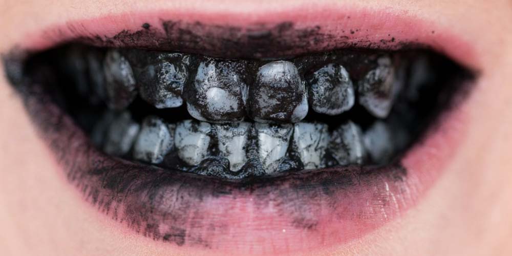 Как се избелват зъбите с активен въглен
